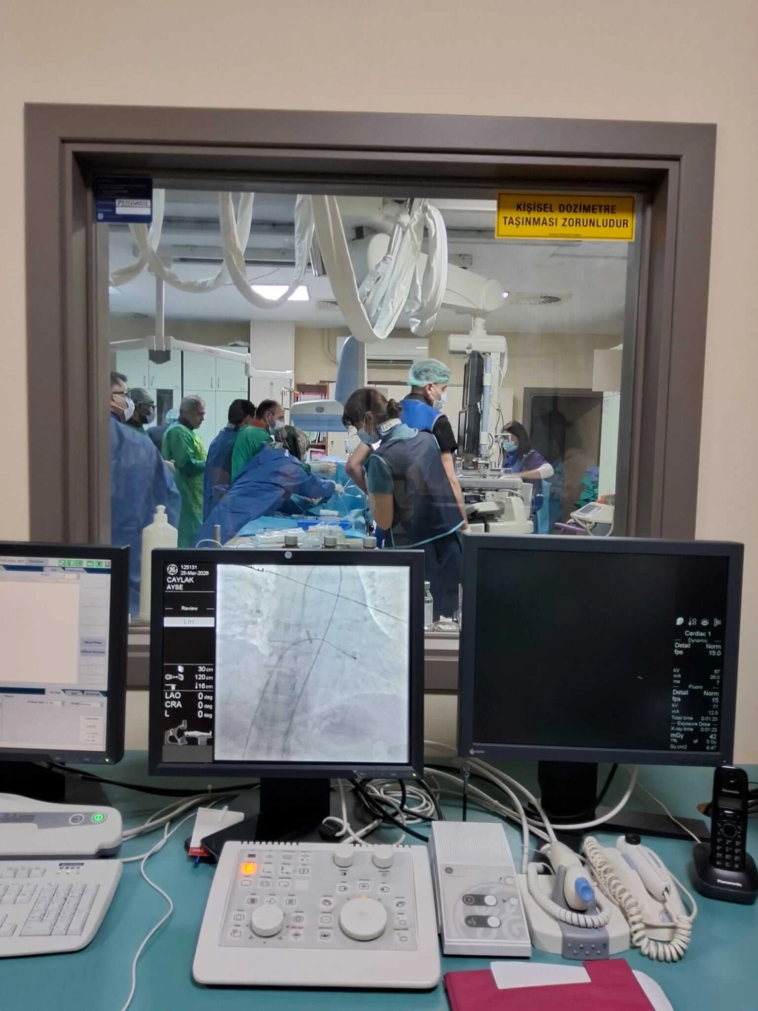 Kırıkkale Tıp Fakültesi’nde Bir İlk: Ameliyatsız Kalp Kapak Değişimi Kardiyoloji Kliniği Tarafından Başarıyla Gerçekleşti