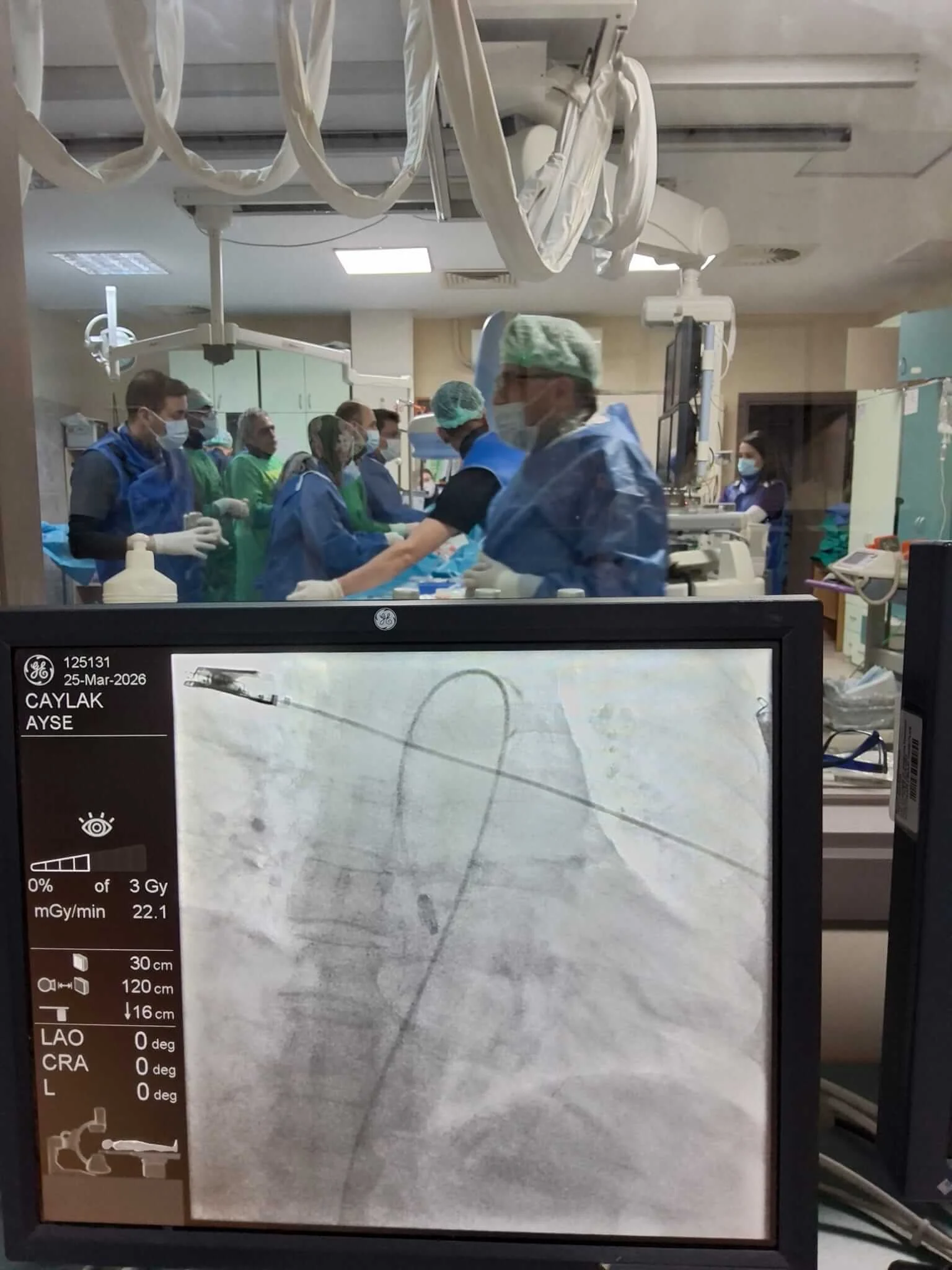 Kırıkkale Tıp Fakültesi’nde Bir İlk: Ameliyatsız Kalp Kapak Değişimi Kardiyoloji Kliniği Tarafından Başarıyla Gerçekleşti